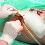Im MPG (Medizinproduktegesetz) ist festgehalten, dass Medizinprodukte gewissen Standards entsprechen müssen.